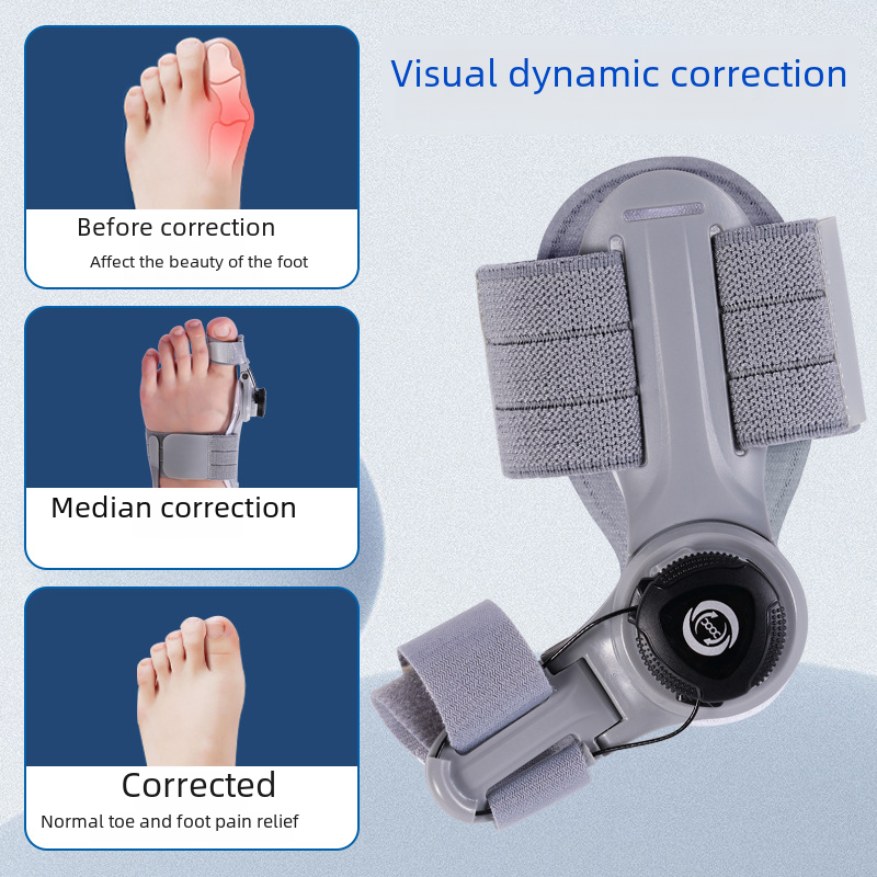 Adjustable Bunion Corrector – Orthopedic Toe Straightener for Pain Relief